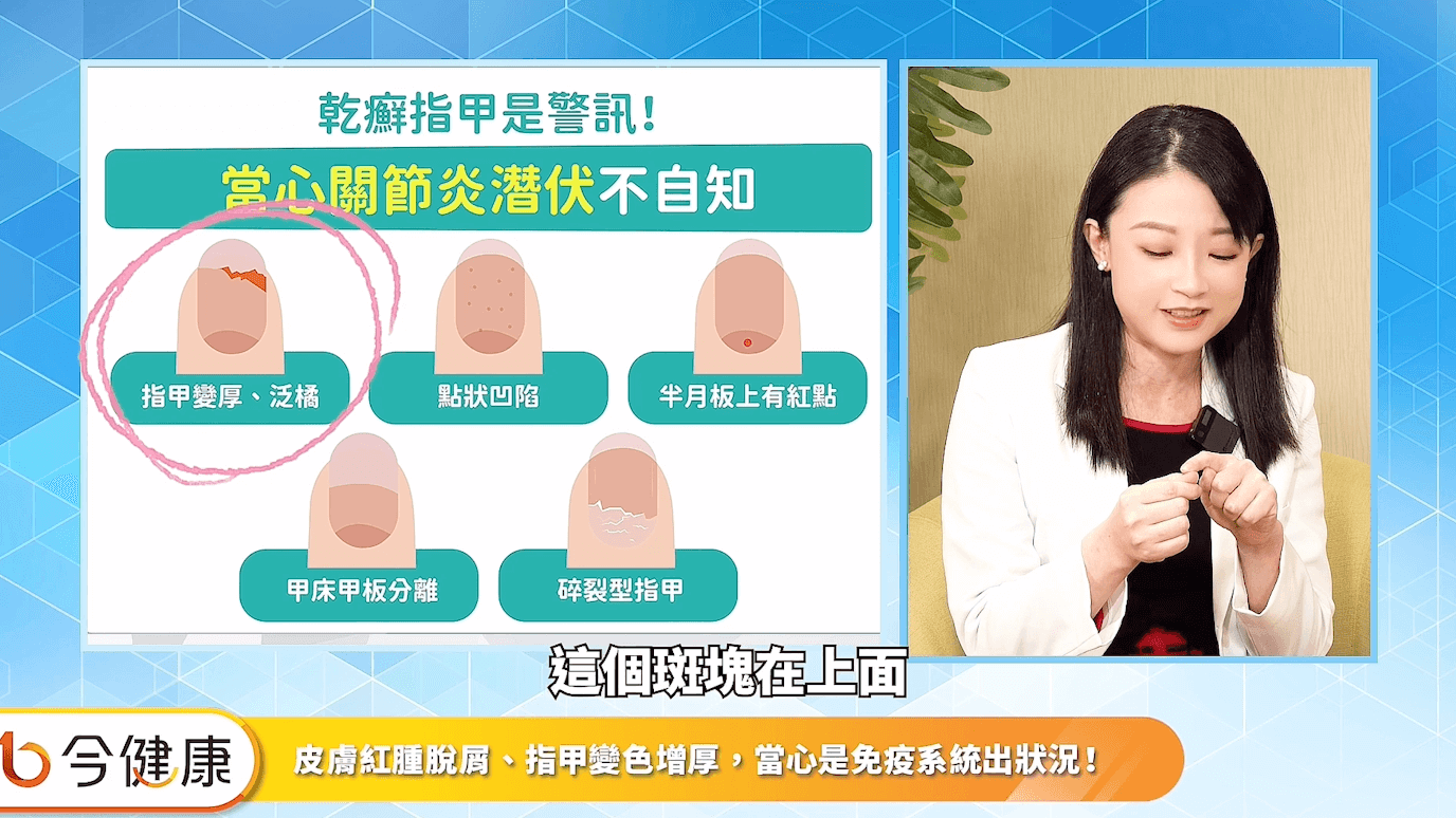 亞東醫院皮膚科蔡雅竹醫師