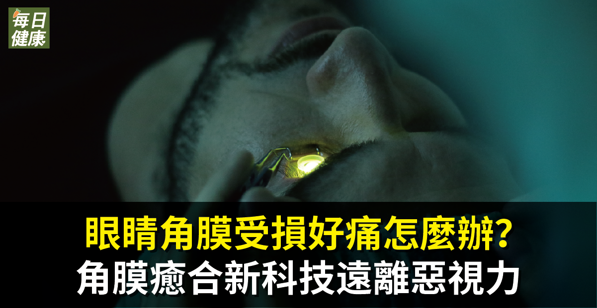 眼睛角膜受損好痛怎麼辦？角膜癒合新科技遠離惡視力