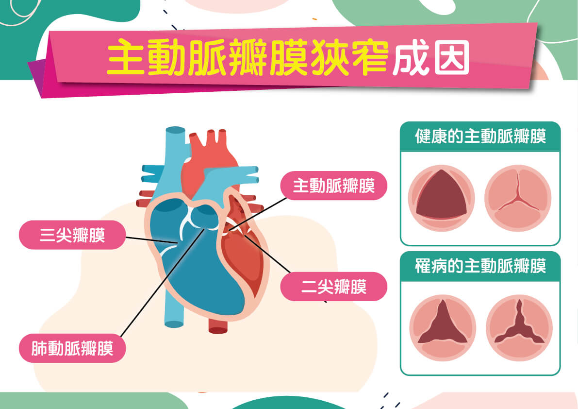 台南奇美醫院心臟血管內科施志遠主任、台南奇美醫院心臟血管外科吳南鈞主任