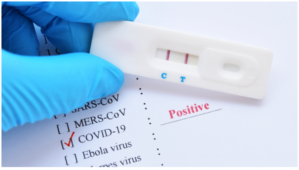 ▲越來越多染疫的康復者表示,腦霧已經影響了他們的工作表現及日常生活。