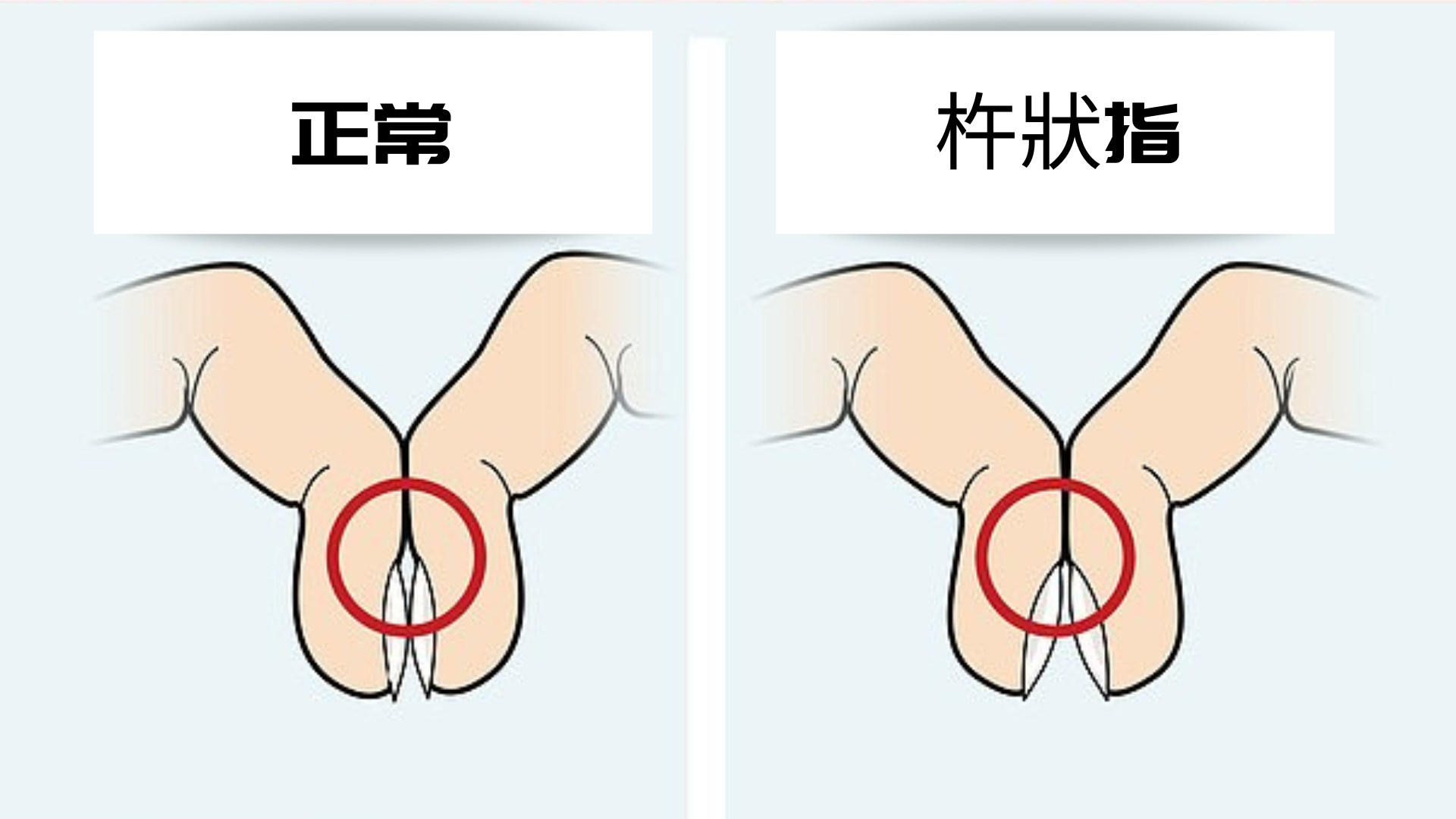 翻攝自/Daily Mail