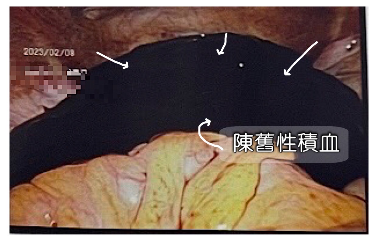 張宇琪醫師 授權提供