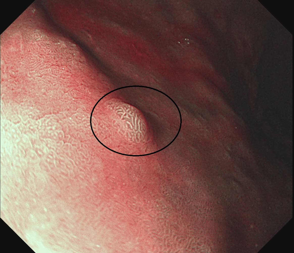 林相宏醫師 授權提供
