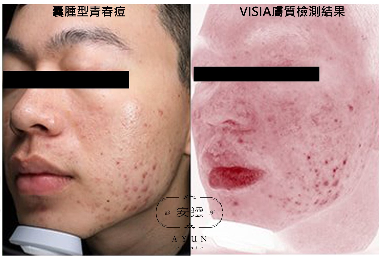 皮膚科醫師高珮菡 授權提供