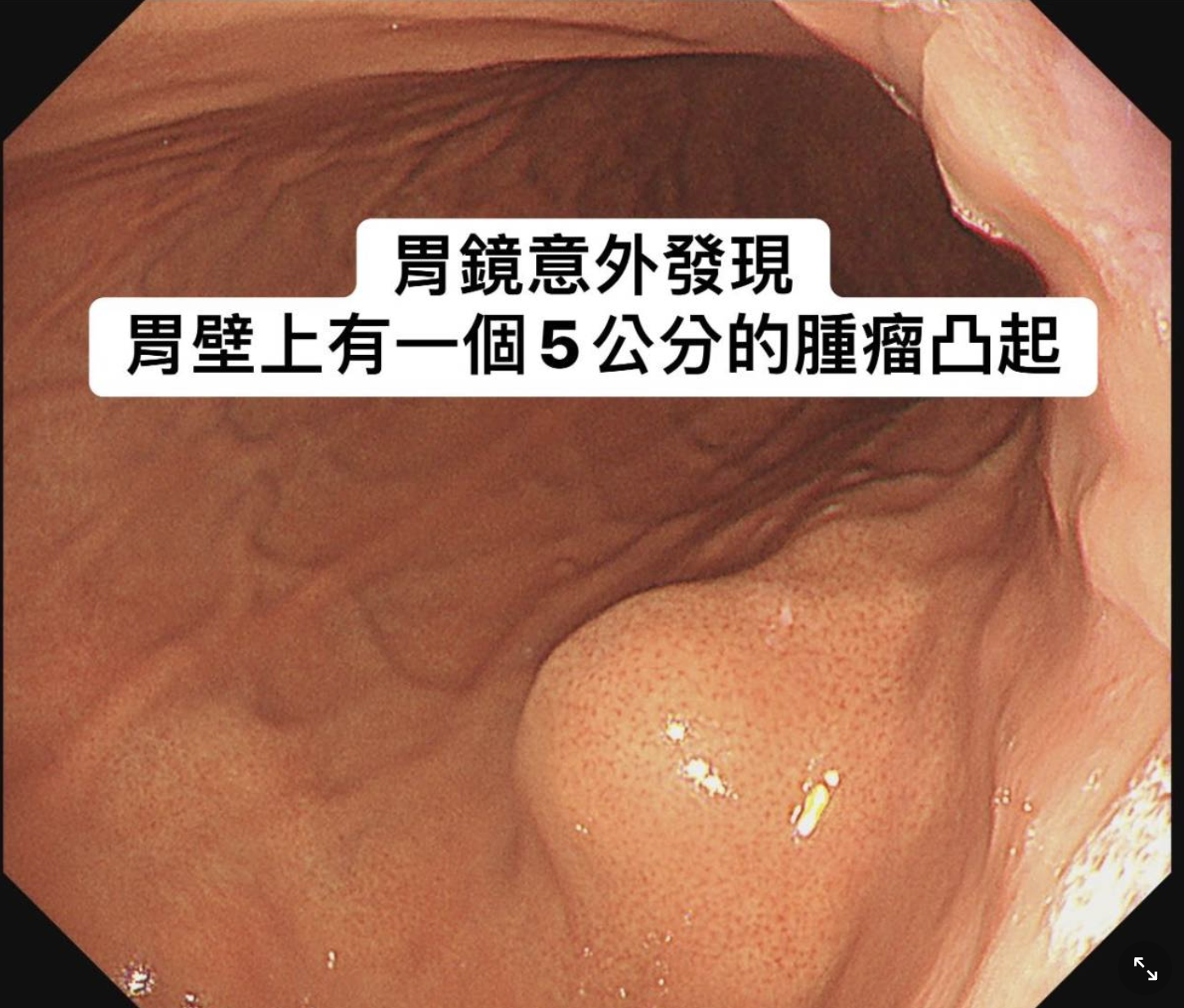 胰臟醫師 林相宏 禾馨民權內科診所