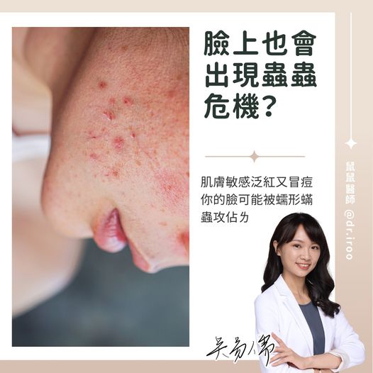 吳易儒醫師授權提供