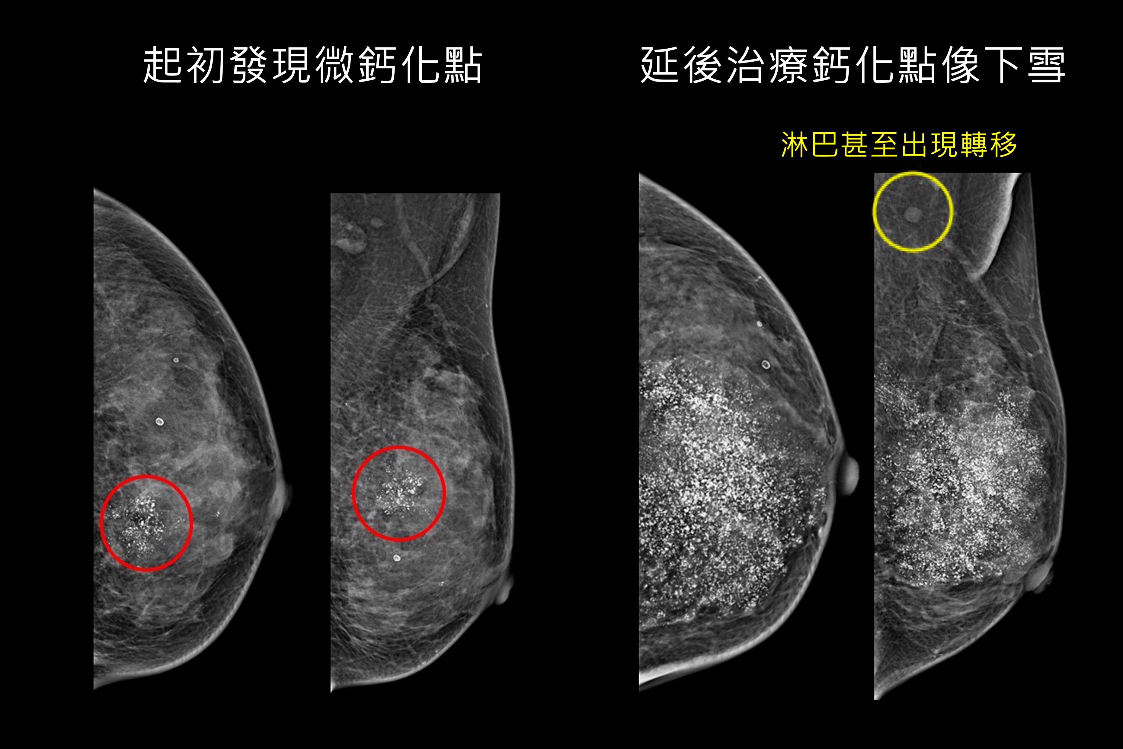 台中慈濟醫院